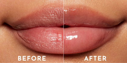 Brightening Lip Serum