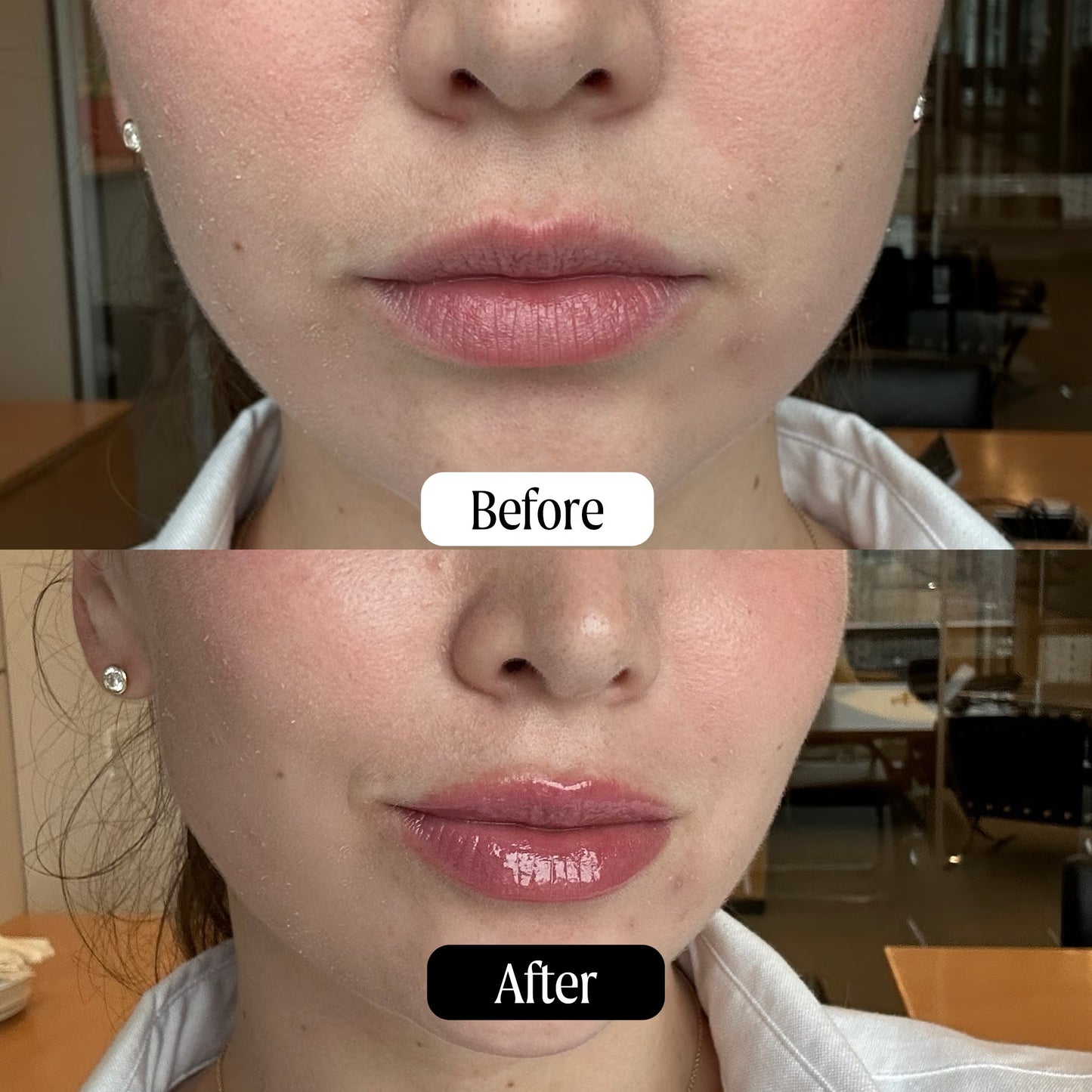 Brightening Lip Serum